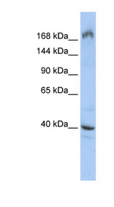 EIF4G1 / EIF4G Antibody - EIF4G1 antibody Western blot of HepG2 cell lysate. This image was taken for the unconjugated form of this product. Other forms have not been tested.