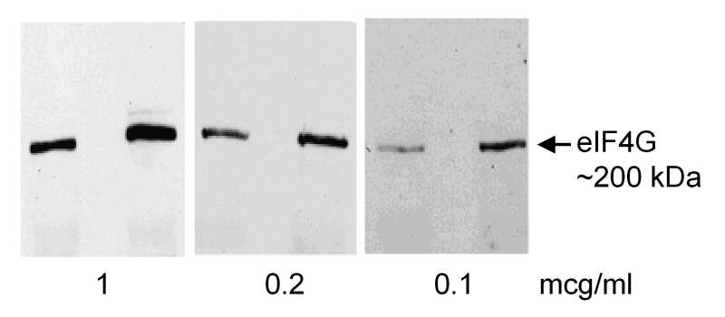EIF4G1 / EIF4G Antibody - Detection of eIF4G by Western Blot. Samples: Rat liver lysate [10K x g supernatant, ~50 ug (left) or 150 ug (right lane)] separated on 7.5% gel and transferred to PVDF membranes. Antibody: Affinity purified rabbit anti-eIF4G used at the indicated concentrations. Detection: Chemiluminescence.