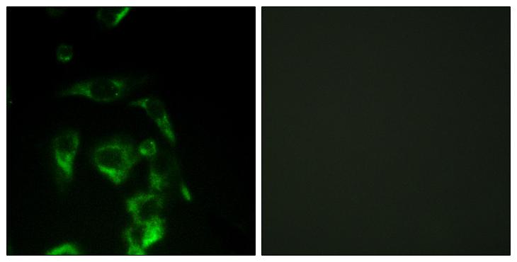 EIF4G1 / EIF4G Antibody - Peptide - + Immunofluorescence analysis of HeLa cells, using Eif4g antibody.