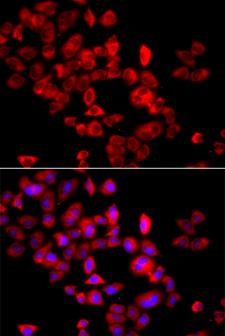 EIF4G1 / EIF4G Antibody - Immunofluorescence analysis of A549 cells.
