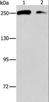EIF4G1 / EIF4G Antibody - Western blot analysis of Lovo and 293T cell, using EIF4G1 Polyclonal Antibody at dilution of 1:450.