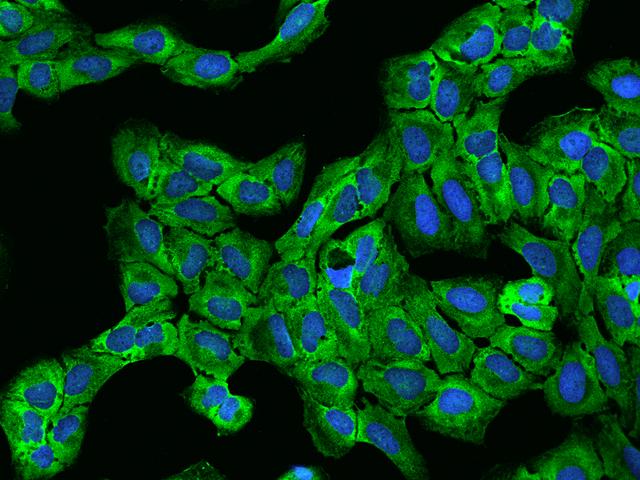 EIF4G1 / EIF4G Antibody - Immunofluorescence staining of EIF4G1 in U2OS cells. Cells were fixed with 4% PFA, permeabilzed with 0.1% Triton X-100 in PBS, blocked with 10% serum, and incubated with rabbit anti-Human EIF4G1 polyclonal antibody (dilution ratio 1:200) at 4°C overnight. Then cells were stained with the Alexa Fluor 488-conjugated Goat Anti-rabbit IgG secondary antibody (green) and counterstained with DAPI (blue). Positive staining was localized to Cytoplasm.