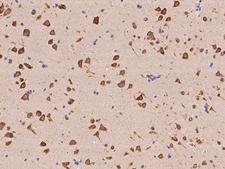EIF4G1 / EIF4G Antibody - Immunochemical staining of human EIF4G1 in human brain with rabbit polyclonal antibody at 1:500 dilution, formalin-fixed paraffin embedded sections.