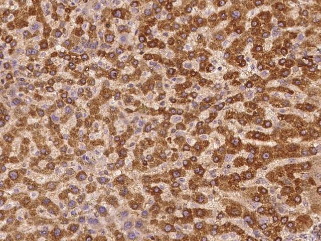 EIF4G1 / EIF4G Antibody - Immunochemical staining of human EIF4G1 in human liver with rabbit polyclonal antibody at 1:500 dilution, formalin-fixed paraffin embedded sections.