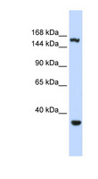EIF4G3 Antibody - EIF4G3 antibody Western blot of HeLa lysate. This image was taken for the unconjugated form of this product. Other forms have not been tested.