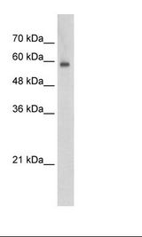 EIF4G3 Antibody - Jurkat Cell Lysate.  This image was taken for the unconjugated form of this product. Other forms have not been tested.