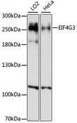 EIF4G3 Antibody - Western blot analysis of extracts of various cell lines, using EIF4G3 antibody at 1:1000 dilution. The secondary antibody used was an HRP Goat Anti-Rabbit IgG (H+L) at 1:10000 dilution. Lysates were loaded 25ug per lane and 3% nonfat dry milk in TBST was used for blocking. An ECL Kit was used for detection and the exposure time was 30s.