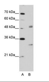 EIF4H Antibody - A: Marker, B: Jurkat Cell Lysate.  This image was taken for the unconjugated form of this product. Other forms have not been tested.