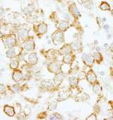 EIF4H Antibody - Detection of Human eIF4H by Immunohistochemistry. Sample: FFPE section of human testicular seminoma. Antibody: Affinity purified rabbit anti-eIF4H used at a dilution of1:200 (1Detection: DAB.