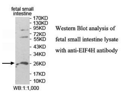 EIF4H Antibody - Western blot of EIF4H antibody