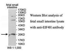 EIF4H Antibody - Western blot of EIF4H antibody