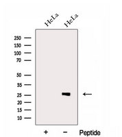 EIF4H Antibody - Western blot analysis of extracts of HeLa cells using EIF4H antibody. The lane on the left was treated with blocking peptide.