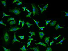 EIF4H Antibody - Immunofluorescence staining of EIF4H in HeLa cells. Cells were fixed with 4% PFA, permeabilzed with 0.1% Triton X-100 in PBS, blocked with 10% serum, and incubated with rabbit anti-human EIF4H polyclonal antibody (dilution ratio 1:1000) at 4°C overnight. Then cells were stained with the Alexa Fluor 488-conjugated Goat Anti-rabbit IgG secondary antibody (green) and counterstained with DAPI (blue). Positive staining was localized to Cytoplasm.