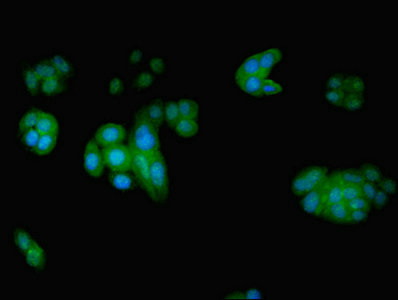 EIF5 Antibody - Immunofluorescent analysis of PC-3 cells using EIF5 Antibody at dilution of 1:100 and Alexa Fluor 488-congugated AffiniPure Goat Anti-Rabbit IgG(H+L)