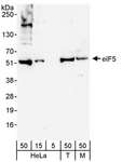 EIF5 Antibody - Detection of Human and Mouse eIF5 by Western Blot. Samples: Whole cell lysate from HeLa (5, 15 and 50 ug for WB; 1 mg for IP, 20% of IP loaded), 293T (T; 50 ug), and mouse NIH3T3 (M; 50 ug) cells. Antibody: Affinity purified rabbit anti-eIF5 antibody used for WB at 0.04 ug/ml. Detection: Chemiluminescence with an exposure time of 3 minutes.