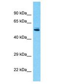 EIF5 Antibody - EIF5 / EIF-5A antibody Western Blot of 293T. Antibody dilution: 1 ug/ml.  This image was taken for the unconjugated form of this product. Other forms have not been tested.