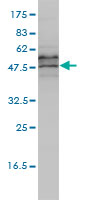 EIF5 Antibody - EIF5 monoclonal antibody (M01), clone 2E6-4C12 Western blot of EIF5 expression in Jurkat.