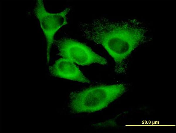 EIF5 Antibody - Immunofluorescence of monoclonal antibody to EIF5 on HeLa cell. [antibody concentration 10 ug/ml]