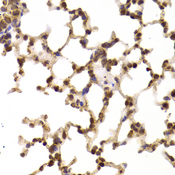 EIF5 Antibody - Immunohistochemistry of paraffin-embedded Rat lung tissue.