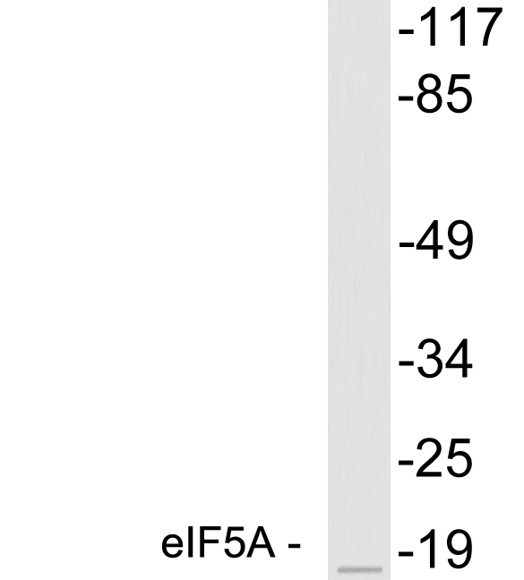 EIF5A Antibody - Western blot analysis of lysates from MCF7 cells, using eIF5A antibody.