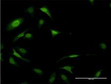 EIF5A Antibody - Immunofluorescence of monoclonal antibody to EIF5A on HeLa cell . [antibody concentration 10 ug/ml]