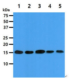 EIF5A Antibody - The cell lysates (40ug) were resolved by SDS-PAGE, transferred to PVDF membrane and probed with anti-human EIF5A antibody (1:1000). Proteins were visualized using a goat anti-mouse secondary antibody conjugated to HRP and an ECL detection system. Lane 1.: Jurkat cell lysate Lane 2.: 293T cell lysate Lane 3.: HeLa cell lysate Lane 4.: MCF7 cell lysate Lane 5.: NIH-3T3 cell lysate