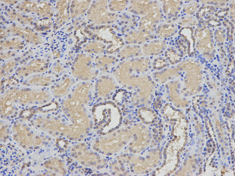 EIF5A Antibody - Immunohistochemistry of paraffin-embedded human kidney using EIF5A antibody at dilution of 1:200 (200x lens).