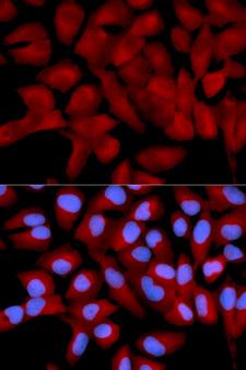 EIF5A Antibody - Immunofluorescence analysis of U2OS cell using EIF5A antibody. Blue: DAPI for nuclear staining.