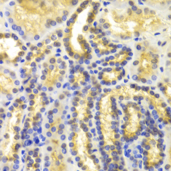 EIF5A Antibody - Immunohistochemistry of paraffin-embedded human kidney tissue.