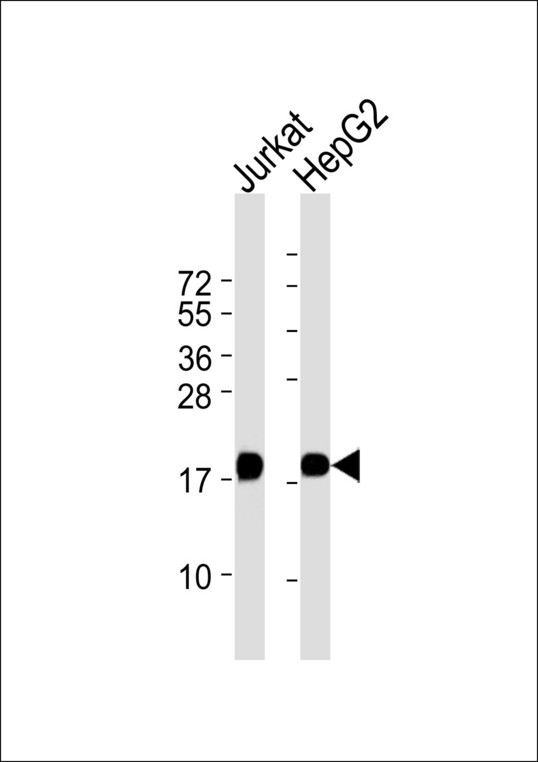 EIF5A Antibody - All lanes : Anti-EIF5A Antibody at 1:1000 dilution Lane 1: Jurkat whole cell lysates Lane 2: HepG2 whole cell lysates Lysates/proteins at 20 ug per lane. Secondary Goat Anti-Rabbit IgG, (H+L),Peroxidase conjugated at 1/10000 dilution Predicted band size : 17 kDa Blocking/Dilution buffer: 5% NFDM/TBST.