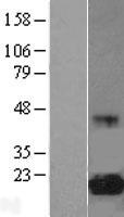 EIF5A Protein - Western validation with an anti-DDK antibody * L: Control HEK293 lysate R: Over-expression lysate