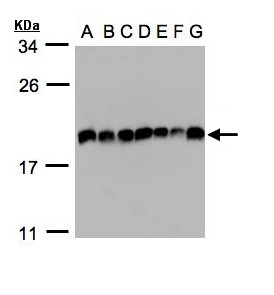 EIF5A2 Antibody - Sample (30g of whole cell lysate). A:293T, B: A431 , C: H1299, D: HeLa S3 , E: Hep G2 . F: MOLT4 . G: Raji . 15% SDS PAGE. EIF5A2 antibody diluted at 1:1000