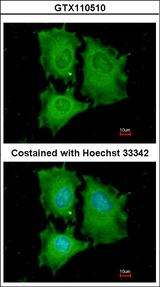 EIF5A2 Antibody - Immunofluorescence of methanol-fixed HeLa using EIF5A2 antibody at 1:200 dilution.