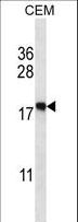 EIF5A2 Antibody - EIF5A2 Antibody western blot of CEM cell line lysates (35 ug/lane). The EIF5A2 antibody detected the EIF5A2 protein (arrow).