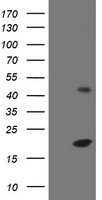 EIF5A2 Antibody - HEK293T cells were transfected with the pCMV6-ENTRY control (Left lane) or pCMV6-ENTRY EIF5A2 (Right lane) cDNA for 48 hrs and lysed. Equivalent amounts of cell lysates (5 ug per lane) were separated by SDS-PAGE and immunoblotted with anti-EIF5A2.