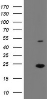 EIF5A2 Antibody - HEK293T cells were transfected with the pCMV6-ENTRY control (Left lane) or pCMV6-ENTRY EIF5A2 (Right lane) cDNA for 48 hrs and lysed. Equivalent amounts of cell lysates (5 ug per lane) were separated by SDS-PAGE and immunoblotted with anti-EIF5A2.