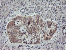 EIF5A2 Antibody - IHC of paraffin-embedded Human pancreas tissue using anti-EIF5A2 mouse monoclonal antibody.