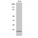 EIF5A2 Antibody - Western blot of eIF5A2 antibody