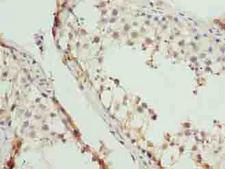 EIF5A2 Antibody - Immunohistochemistry of paraffin-embedded human testis tissue using antibody at dilution of 1:100.