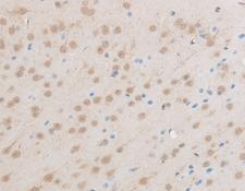 EIF5A2 Antibody - Immunohistochemistry of paraffin-embedded Mouse brain using EIF5A2 Polyclonal Antibody at dilution of 1:50.