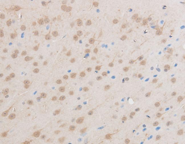 EIF5A2 Antibody - Immunohistochemistry of paraffin-embedded Mouse brain using EIF5A2 Polyclonal Antibody at dilution of 1:50.
