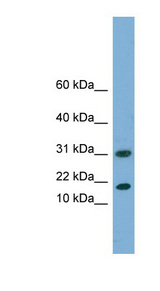 EIF5A2 Antibody - EIF5A2 antibody Western blot of Fetal Liver lysate. This image was taken for the unconjugated form of this product. Other forms have not been tested.