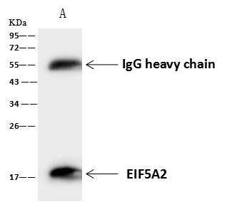 EIF5A2 Antibody - EIF5A2 was immunoprecipitated using: Lane A: 0.5 mg A431 Whole Cell Lysate. 4 uL anti-EIF5A2 rabbit polyclonal antibody and 60 ug of Immunomagnetic beads Protein A/G. Primary antibody: Anti-EIF5A2 rabbit polyclonal antibody, at 1:100 dilution. Secondary antibody: Goat Anti-Rabbit IgG (H+L)/HRP at 1/10000 dilution. Developed using the ECL technique. Performed under reducing conditions. Predicted band size: 17 kDa. Observed band size: 17 kDa.