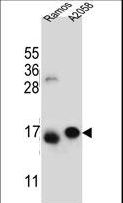 EIF5AL1 Antibody - EIF5AL1 Antibody western blot of Ramos,A2058 cell line lysates (35 ug/lane). The EIF5AL1 antibody detected the EIF5AL1 protein (arrow).