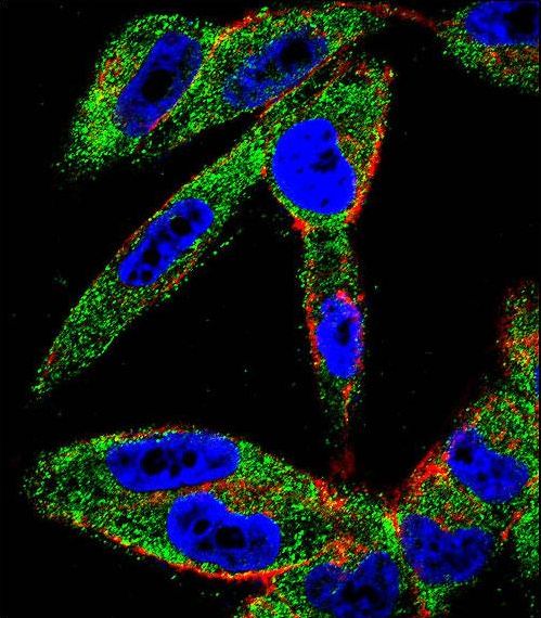EIF5AL1 Antibody - Confocal immunofluorescence of EIF5AL1 Antibody with A2058 cell followed by Alexa Fluor 488-conjugated goat anti-rabbit lgG (green). Actin filaments have been labeled with Alexa Fluor 555 phalloidin (red). DAPI was used to stain the cell nuclear (blue).
