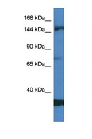 EIF5B / IF2 Antibody - EIF5B antibody Western blot of Jurkat Cell lysate. Antibody concentration 1 ug/ml.  This image was taken for the unconjugated form of this product. Other forms have not been tested.