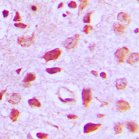 EIF5B / IF2 Antibody - Immunohistochemical analysis of EIF5B staining in human brain formalin fixed paraffin embedded tissue section. The section was pre-treated using heat mediated antigen retrieval with sodium citrate buffer (pH 6.0). The section was then incubated with the antibody at room temperature and detected using an HRP conjugated compact polymer system. DAB was used as the chromogen. The section was then counterstained with hematoxylin and mounted with DPX.