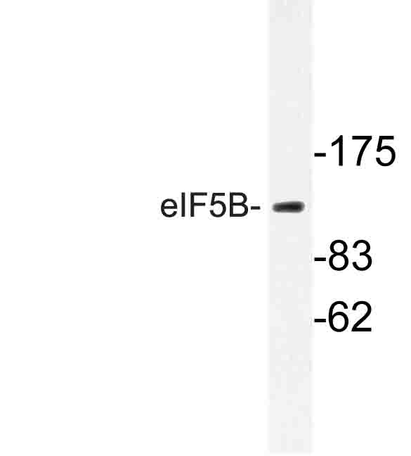 EIF5B / IF2 Antibody - Western blot of eIF5B (H1086) pAb in extracts from Jurkat cells.