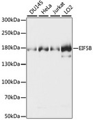 EIF5B / IF2 Antibody - Western blot analysis of extracts of various cell lines, using EIF5B antibody. The secondary antibody used was an HRP Goat Anti-Rabbit IgG (H+L) at 1:10000 dilution. Lysates were loaded 25ug per lane and 3% nonfat dry milk in TBST was used for blocking. An ECL Kit was used for detection and the exposure time was 3s.