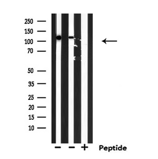 EIF5B / IF2 Antibody - Western blot analysis of EIF5B expression in various lysates